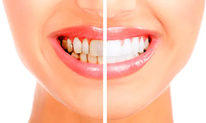 Dentista - Estética