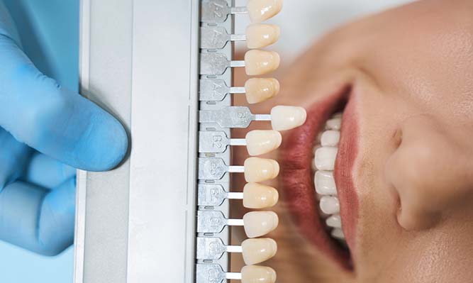 dentisticai Clareamento interno - Tratamento de canal